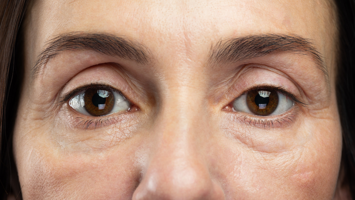 Dark Circles and Fatigue: How to Restore a Fresh Look