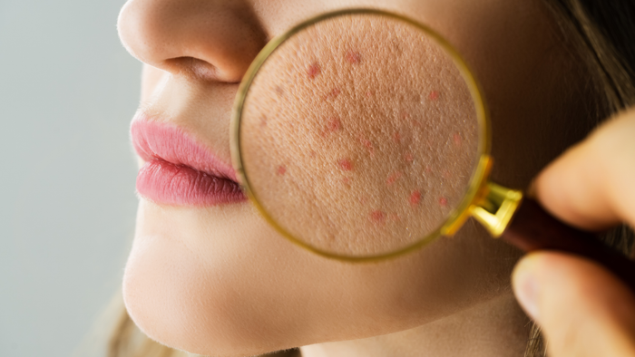 Pourquoi votre peau a besoin d'une barrière cutanée solide pour rester jeune
