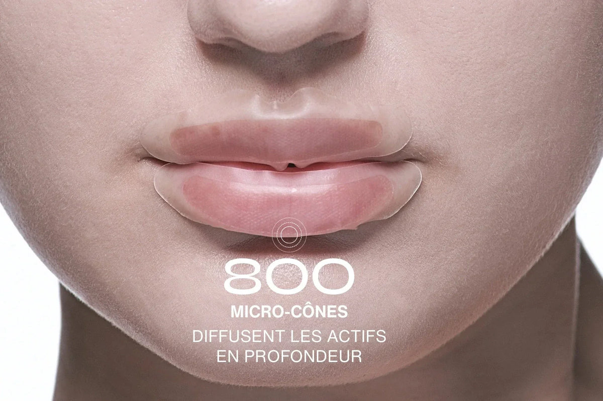 Ridules des lèvres et contour de la bouche : pourquoi elles arrivent si tôt