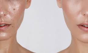 Oily Skin Routine: 10 Steps for Perfect Skin