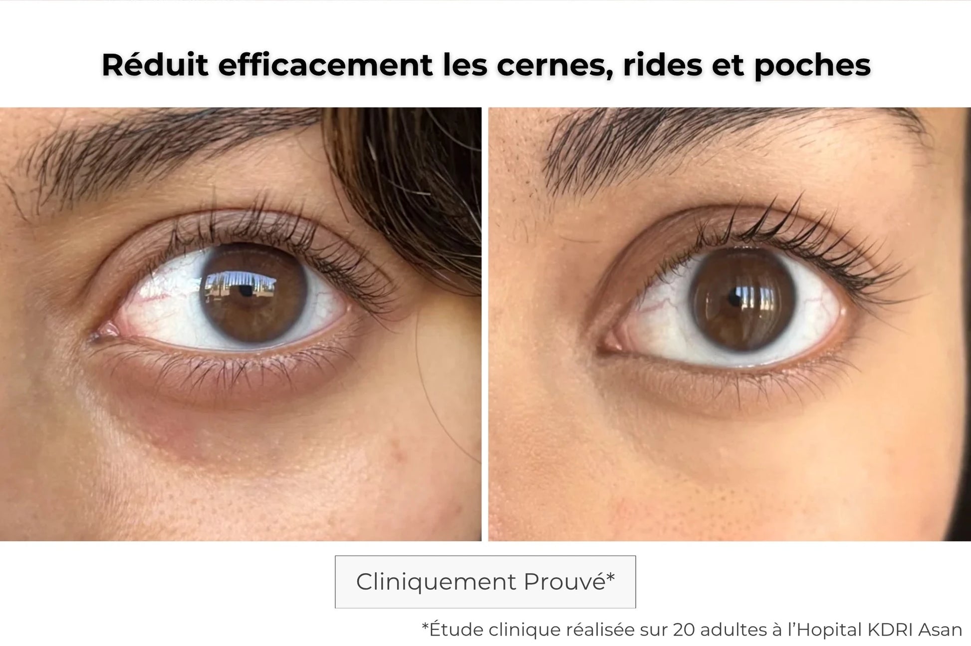 Avant / après patch contour des yeux Kósmopellis — effet lissant visible et regard éclatant