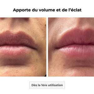 Cure Visage Complet