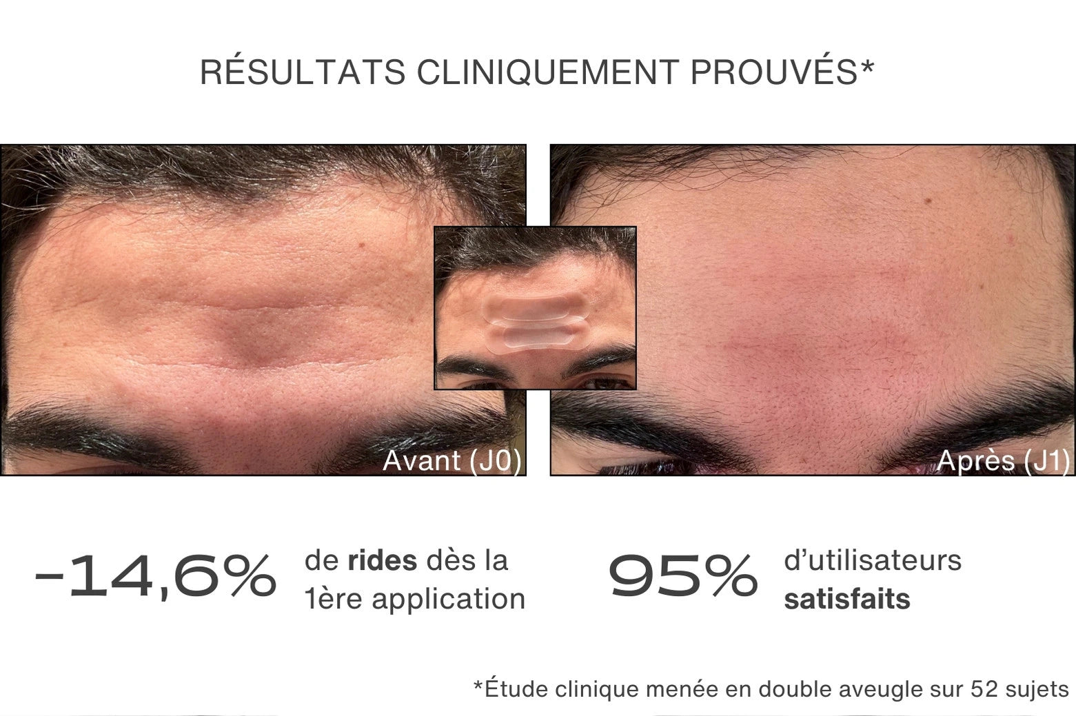 Avant / Après pour le patch anti-rides - résultats cliniquement prouvés