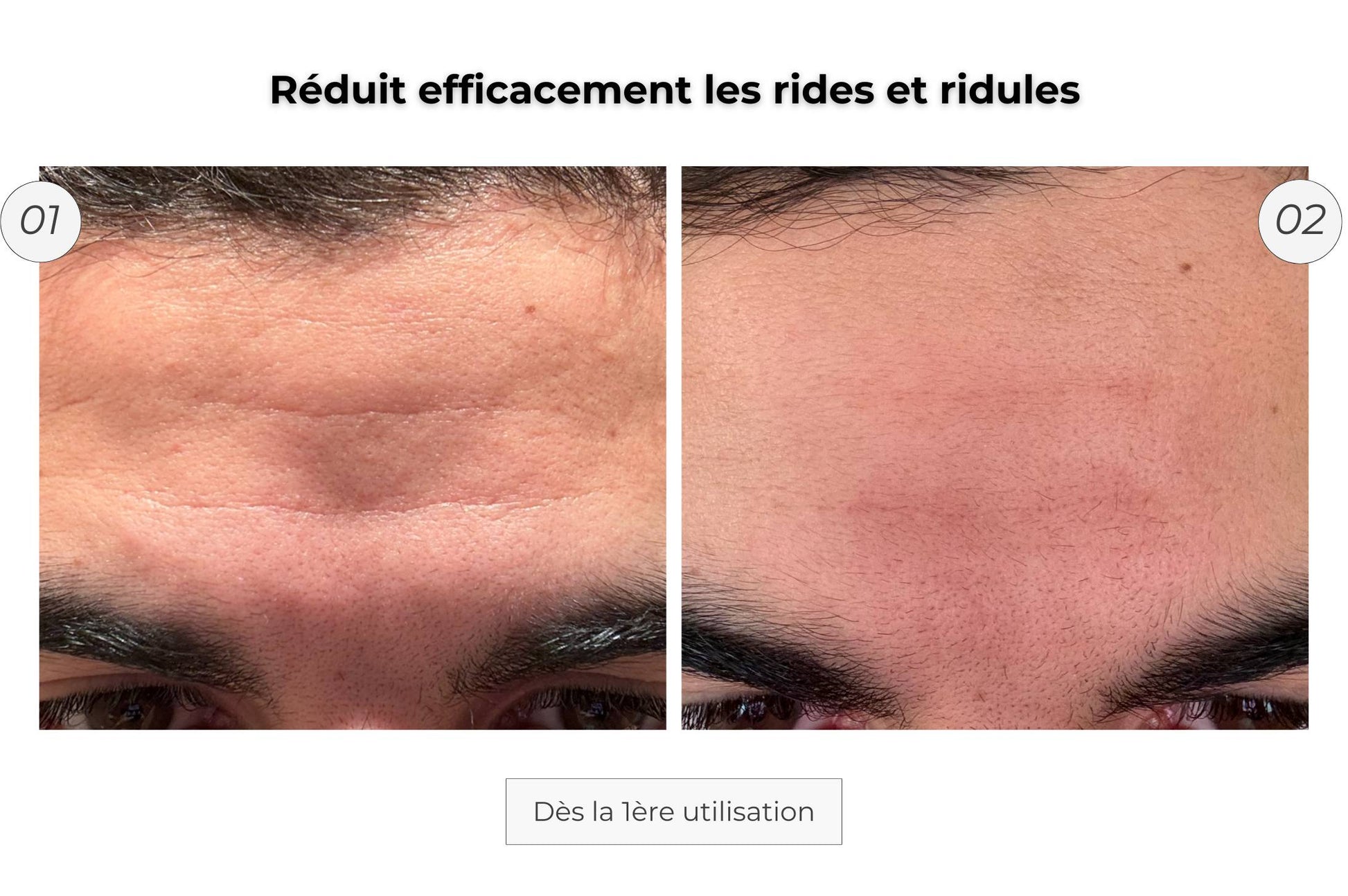 Cure Visage Complet