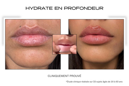 Avant Après hydratation avec le patch lèvres microneedling 
