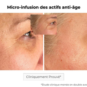Patch Anti-Âge Microneedling | Traitement des Rides en Profondeur ...
