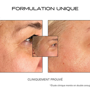 Avant / Après utilisation du patch anti-rides sur les pattes d'oies