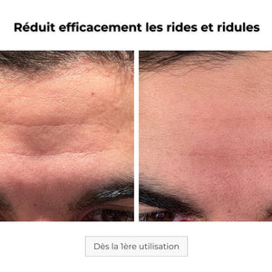Cure Visage Complet