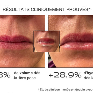 Avant / Après pour le patch lèvres - résultats cliniquement prouvés