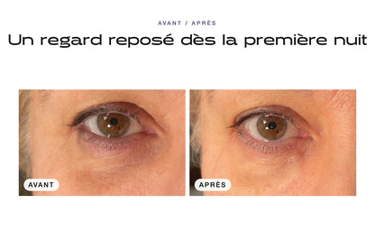 Avant / après : regard visiblement reposé dès la première nuit avec le Patch Contour des Yeux