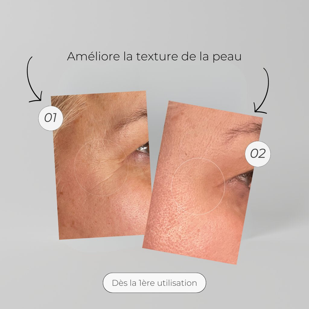 Patch Anti-Âge Microneedling