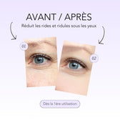 Résultats anti-rides, anti-cernes et anti-poches pour le patch contour des yeux microneedling