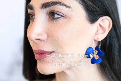 patch anti-âge microneedling pour les rides du sillon nasogénien